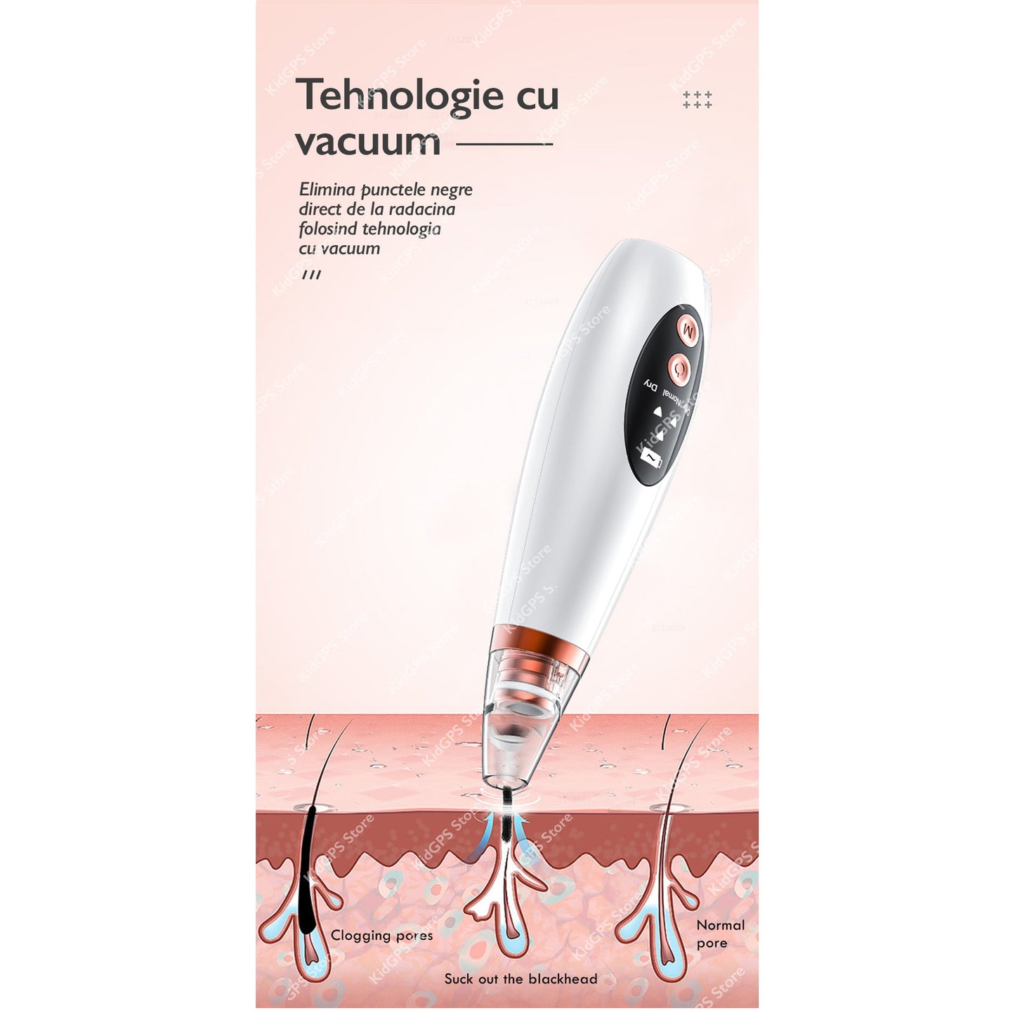 Aparat electric pentru scos puncte negre, Horigen™ DLH054