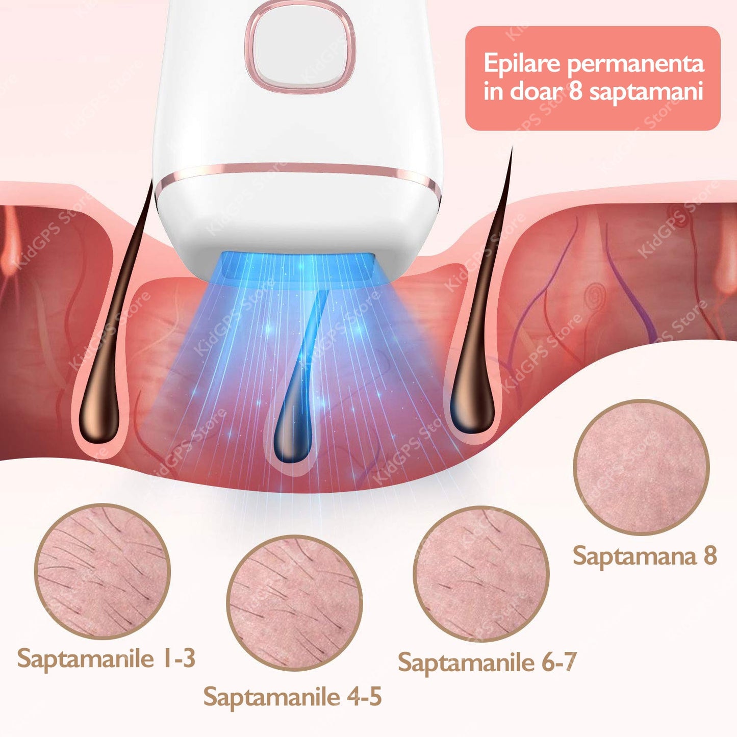 Epilator IPL Horigen® T5